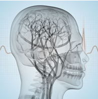 Schlaganfall_Ergotherapie_Seligenthal Schlaganfall_Ergotherapie_Seligenthal